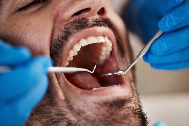Best Tooth Infection Emergency Dentist  in Haskell, AR