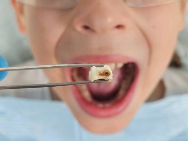 Best Broken Tooth Emergency  in Haskell, AR