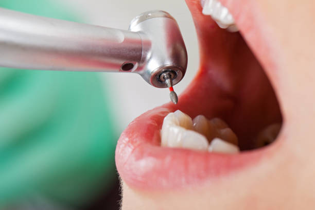 Best Dentist for Tooth Abscess  in Haskell, AR